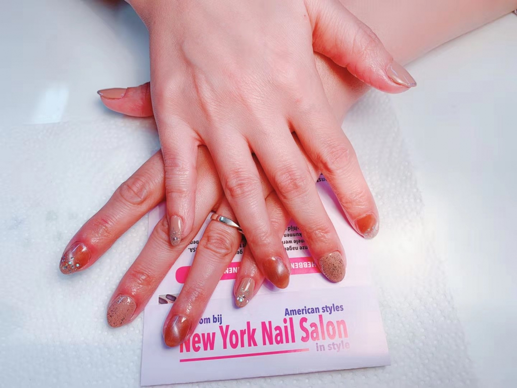 Nagels