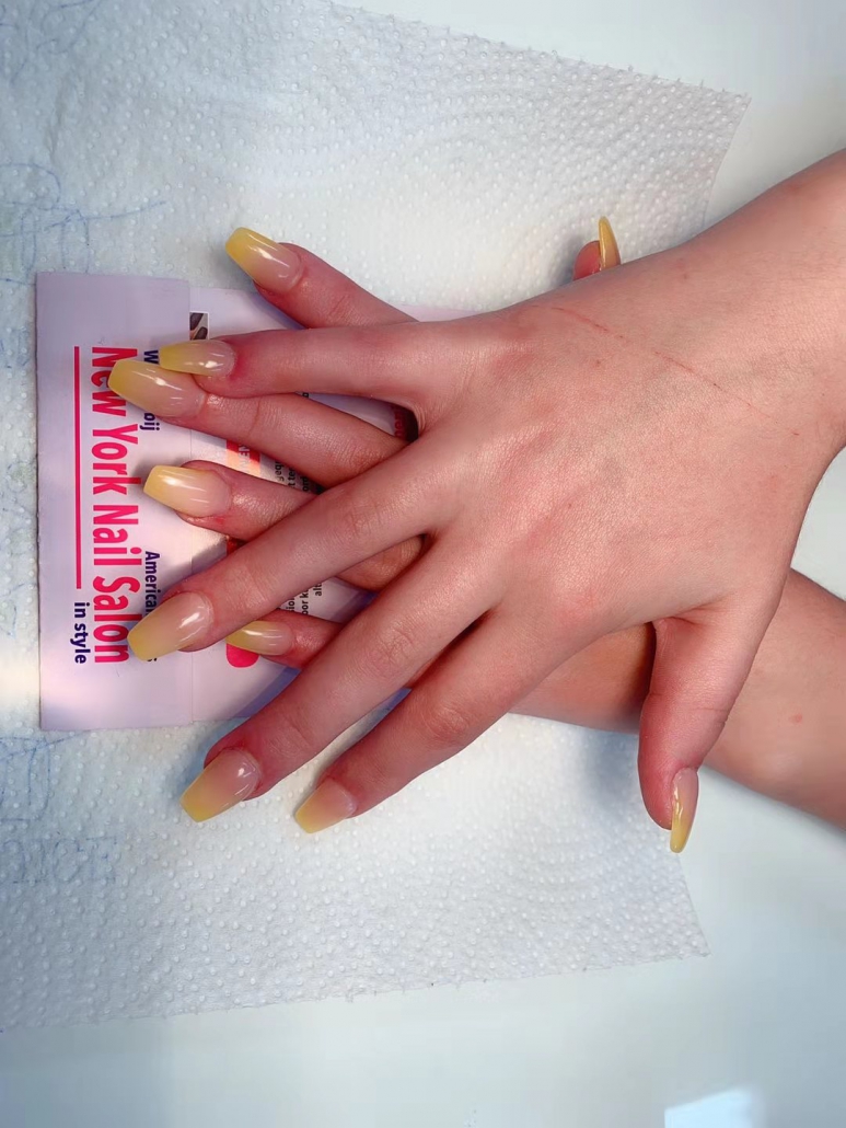 Nagels